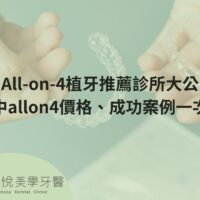 台中All-on-4植牙推薦診所大公開！台中allon4價格、成功案例一次看
