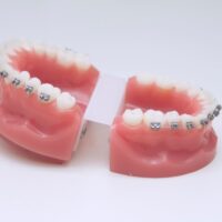 teeth-2022-11-15-23-14-12-utc (3) (1)