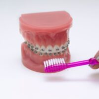 teeth-2022-11-15-23-14-24-utc (1)