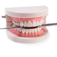 white-teeth-2021-08-30-08-39-52-utc (3)