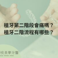will-the-second-stage-of-dental-implantation-hurt