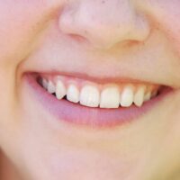 young-woman-with-toothy-smile-and-perfect-white-te-2022-11-16-17-06-37-utc (2)