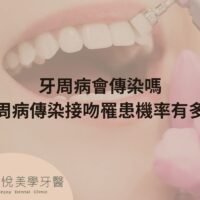 補骨粉不能省，醫：忽略補骨恐釀植牙失敗 (1)
