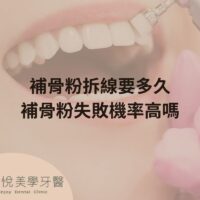 補骨粉不能省，醫：忽略補骨恐釀植牙失敗 (1)