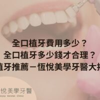 補骨粉不能省，醫：忽略補骨恐釀植牙失敗 (1)