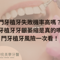 補骨粉不能省，醫：忽略補骨恐釀植牙失敗