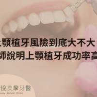 補骨粉不能省，醫：忽略補骨恐釀植牙失敗 (2)