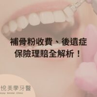 補骨粉不能省，醫：忽略補骨恐釀植牙失敗 (2)