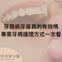 補骨粉不能省，醫：忽略補骨恐釀植牙失敗 (3)