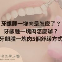 牙齦腫一塊肉是怎麼了？牙齦腫一塊肉怎麼辦？牙齦腫一塊肉5個舒緩方式