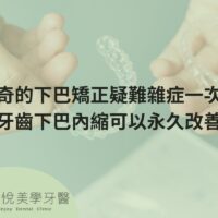 補骨粉不能省，醫：忽略補骨恐釀植牙失敗 (5)