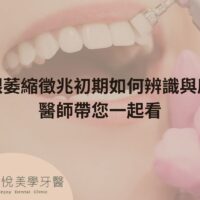補骨粉不能省，醫：忽略補骨恐釀植牙失敗 (5)