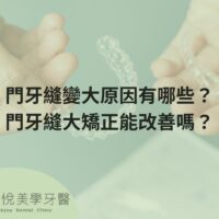 補骨粉不能省，醫：忽略補骨恐釀植牙失敗 (6)