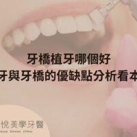 補骨粉不能省，醫：忽略補骨恐釀植牙失敗
