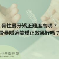 補骨粉不能省，醫：忽略補骨恐釀植牙失敗 (7)