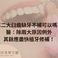補骨粉不能省，醫：忽略補骨恐釀植牙失敗 (8)