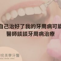 補骨粉不能省，醫：忽略補骨恐釀植牙失敗