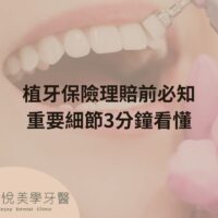 補骨粉不能省，醫：忽略補骨恐釀植牙失敗
